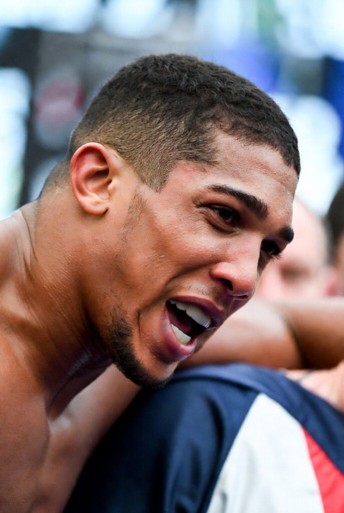 Anthony Joshua Winces 